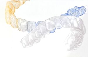 マウスピース型矯正装置、SureSmile(シュアスマイル)なら、港区赤坂・溜池山王の歯医者、寺西歯科医院まで。